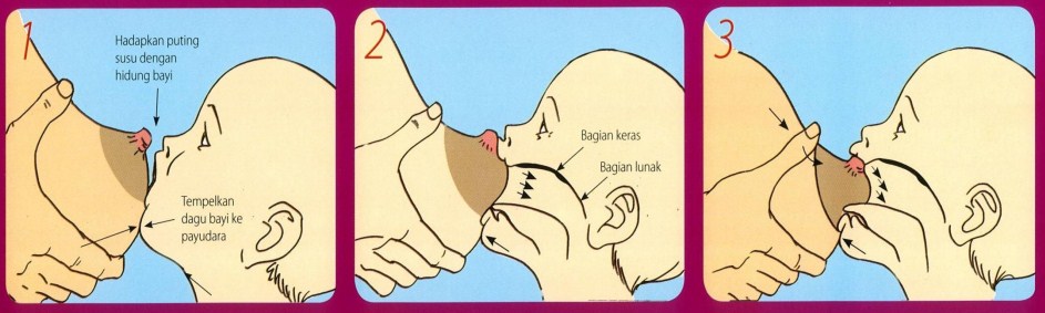 Posisi Pelekatan Mulut dan Puting Saat Menyusui 1
