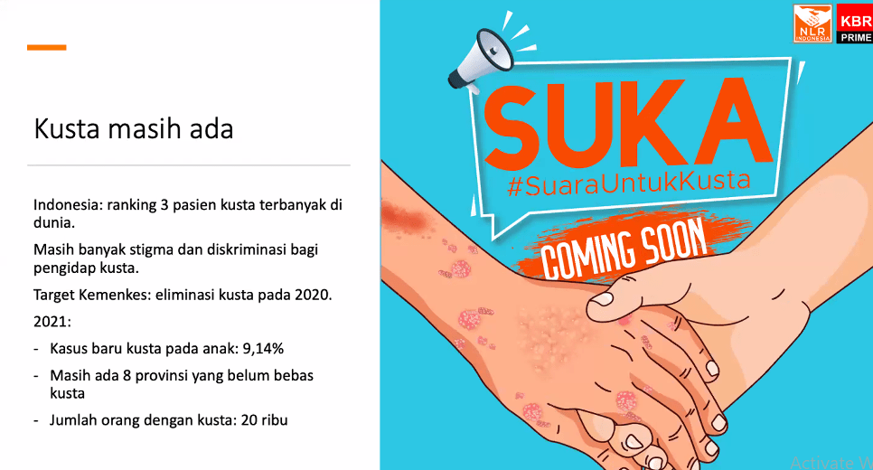 Jangan Ada Kusta Diantara Kita! 2 kusta di indonesia