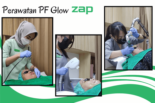 Review ZAP Clinic Manyar, Pengalaman Perawatan Photo Facial Glow 3 Proses Treatment yang Dilakukan oleh dokter ZAP Clinic Manyar